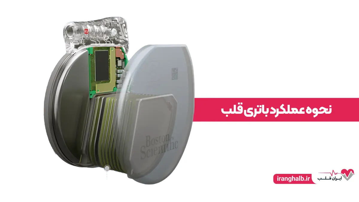 نحوه عملکرد باتری قلب نحوه عملکرد باتری قلب