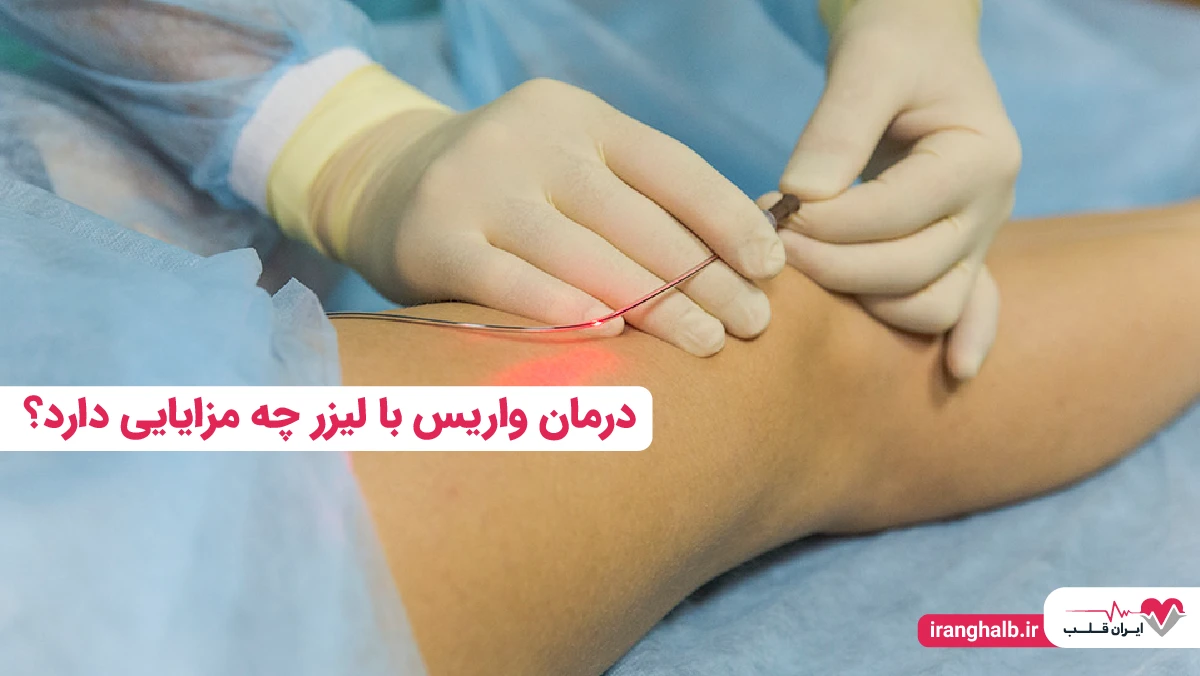 درمان واریس با لیزر چه مزایایی دارد؟