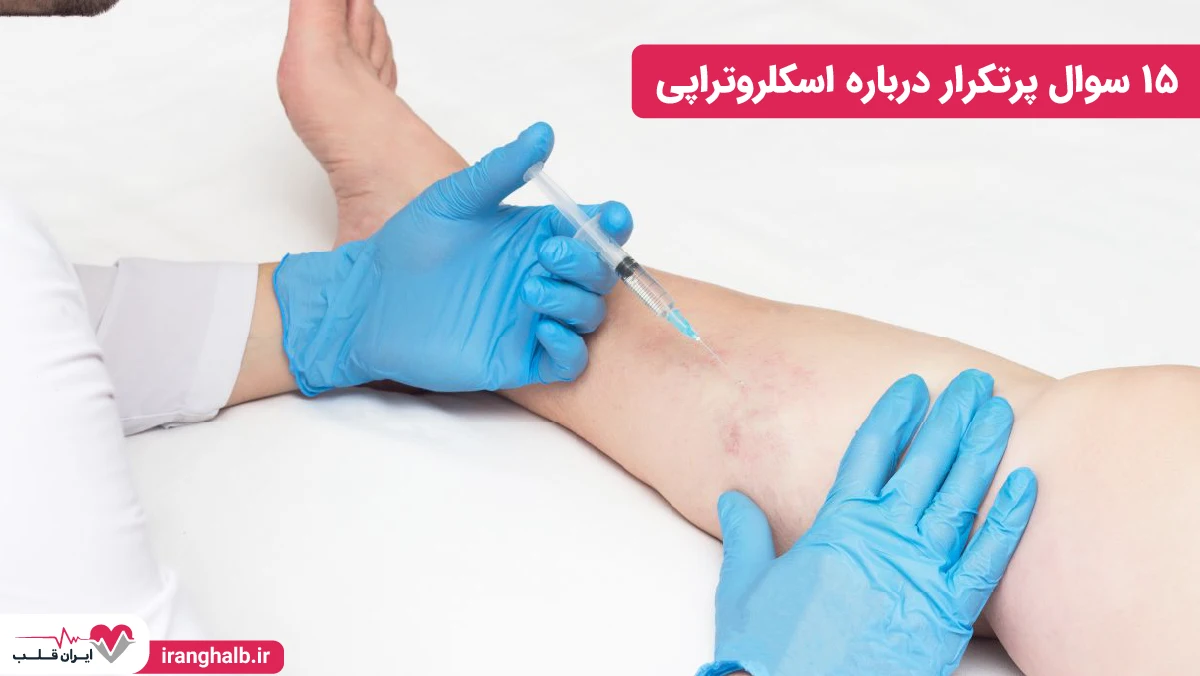 ۱۵ سوال پرتکرار درباره اسکلروتراپی ۱۵ سوال پرتکرار درباره اسکلروتراپی