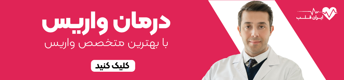 درمان سریع واریس