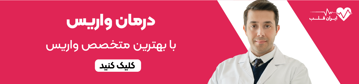 درمان واریس