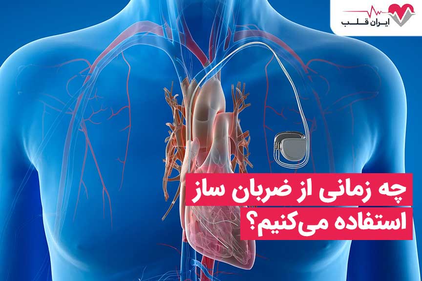 چه زمانی از دستگاه ضربان ساز استفاده می‌کنیم