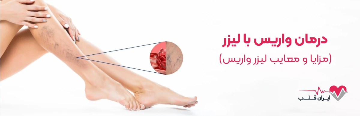 درمان واریس با لیزر (مزایا و معایب لیزر واریس)