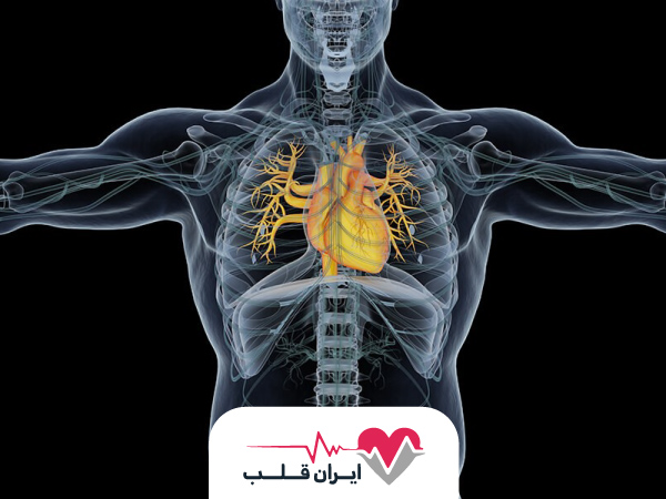 ام آر آی قلب چیست و همه چیز درباره ام آر آی قلب