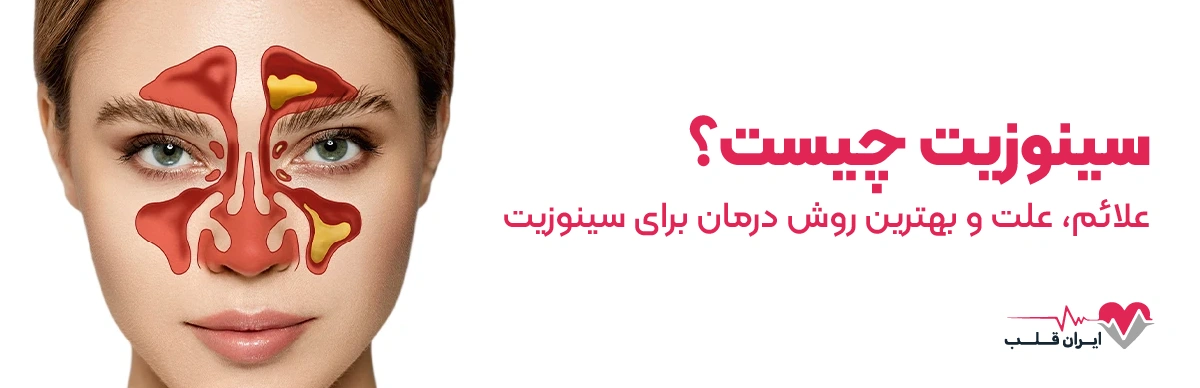 سینوزیت چیست | علائم، علت و بهترین روش درمان برای سینوزیت
