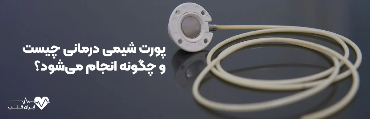پورت شیمی درمانی چیست و چگونه انجام می‌شود؟