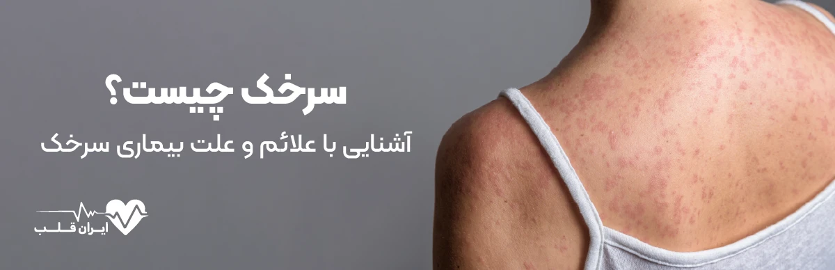 سرخک چیست؟ | آشنایی با علائم و علت بیماری سرخک + راه درمان