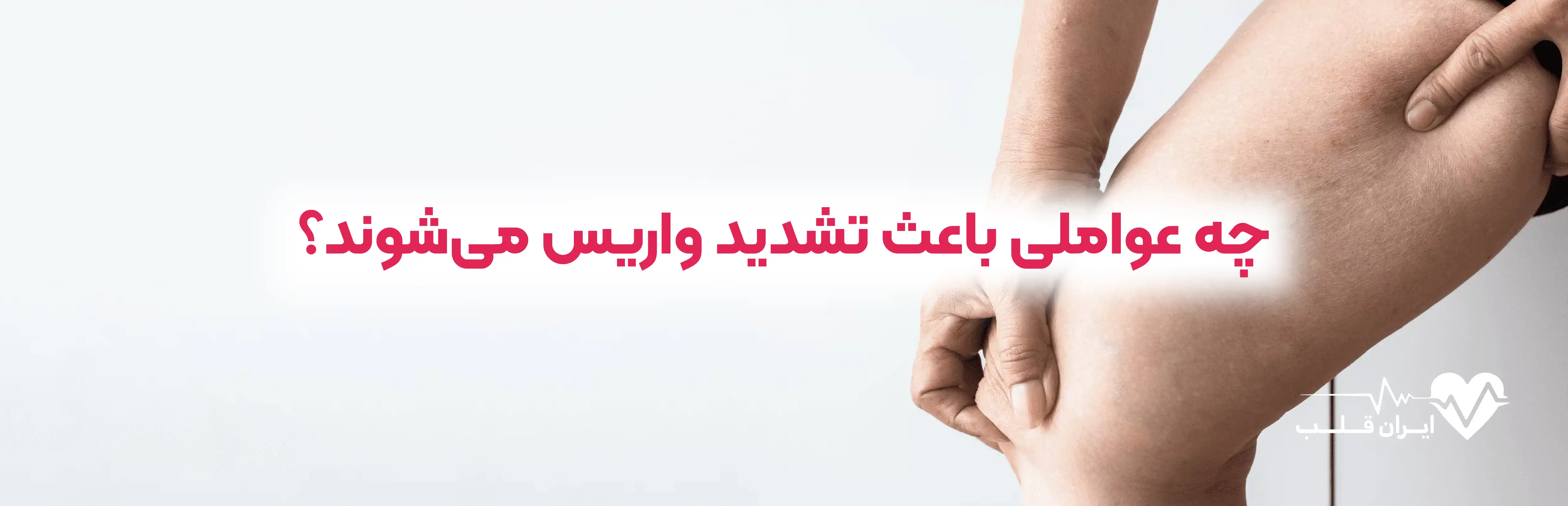 چه عواملی باعث تشدید واریس می شوند؟