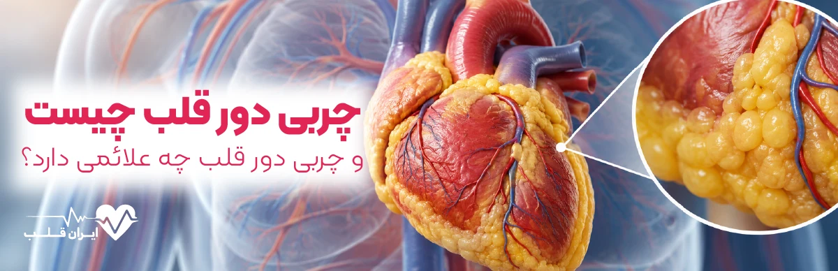 چربی دور قلب چیست و چه علائمی دارد؟