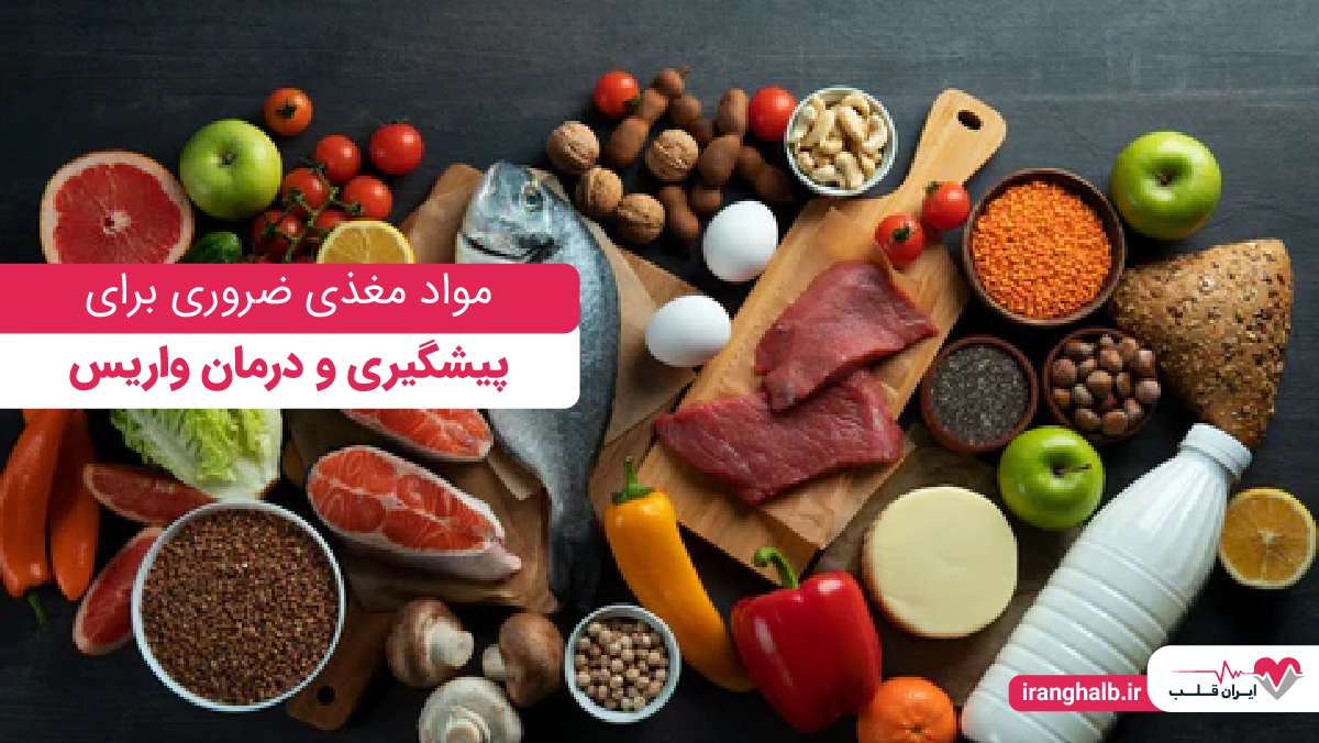 مواد مغذی ضروری برای پیشگیری و درمان واریس مواد مغذی ضروری برای پیشگیری و درمان واریس