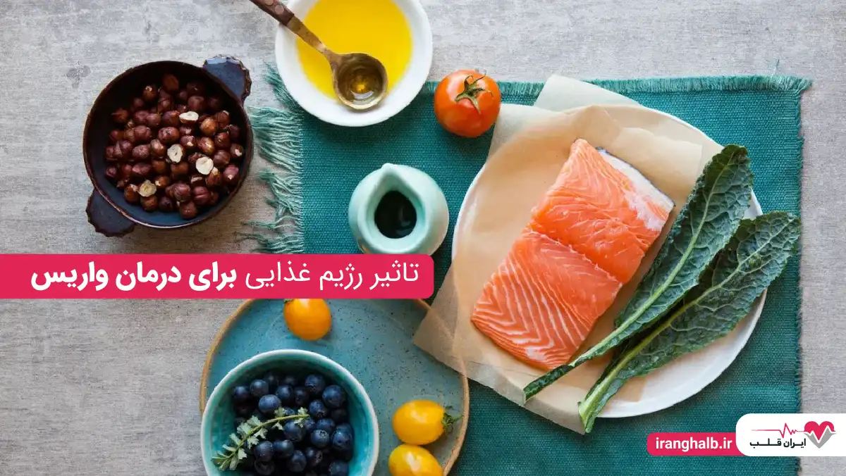 تاثیر رژیم غذایی برای درمان واریس تاثیر رژیم غذایی برای درمان واریس