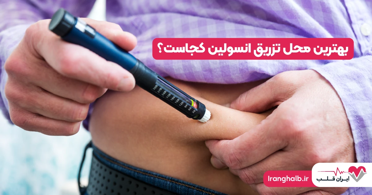 بهترین محل تزریق انسولین کجاست؟