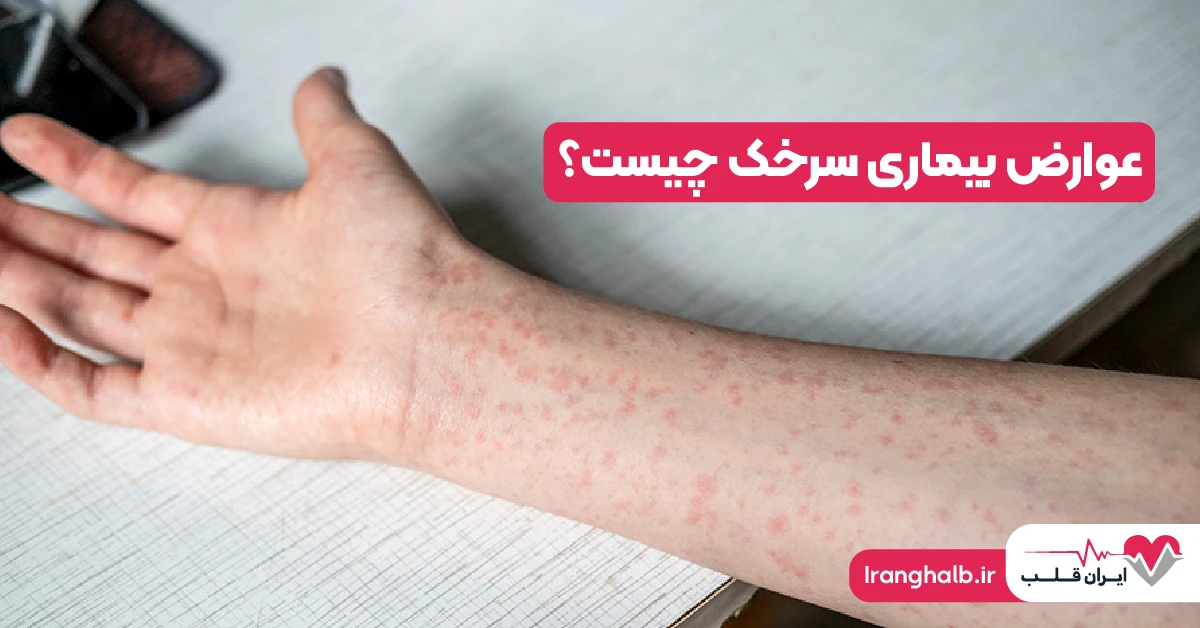 عوارض بیماری سرخک چیست؟