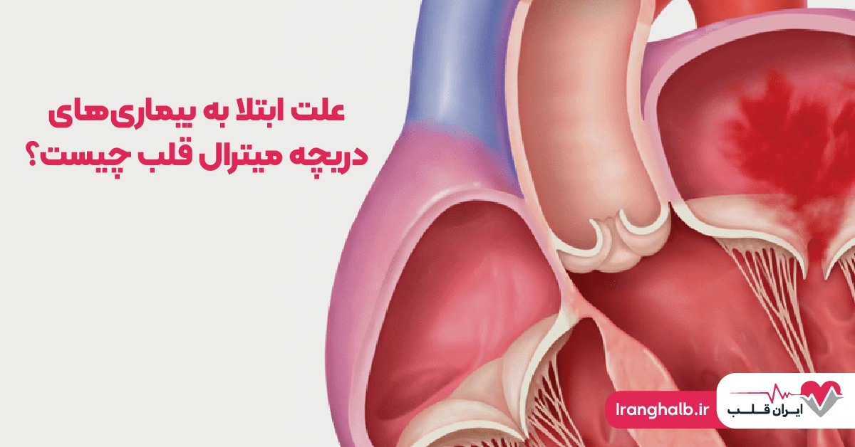 علت ابتلا به بیماریهای دریچه میترال قلب چیست؟ علت ابتلا به بیماریهای دریچه میترال قلب چیست؟