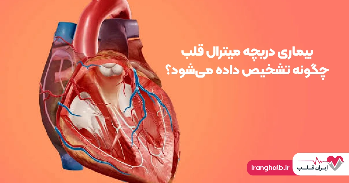 بیماری دریچه میترال قلب چگونه تشخیص داده میشود؟ بیماری دریچه میترال قلب چگونه تشخیص داده میشود؟