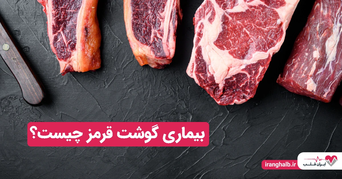 بیماری گوشت قرمز چیست؟