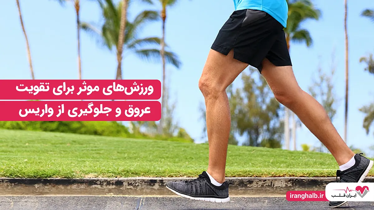 ورزش های موثر برای تقویت عروق و جلوگیری از واریس ورزش های موثر برای تقویت عروق و جلوگیری از واریس