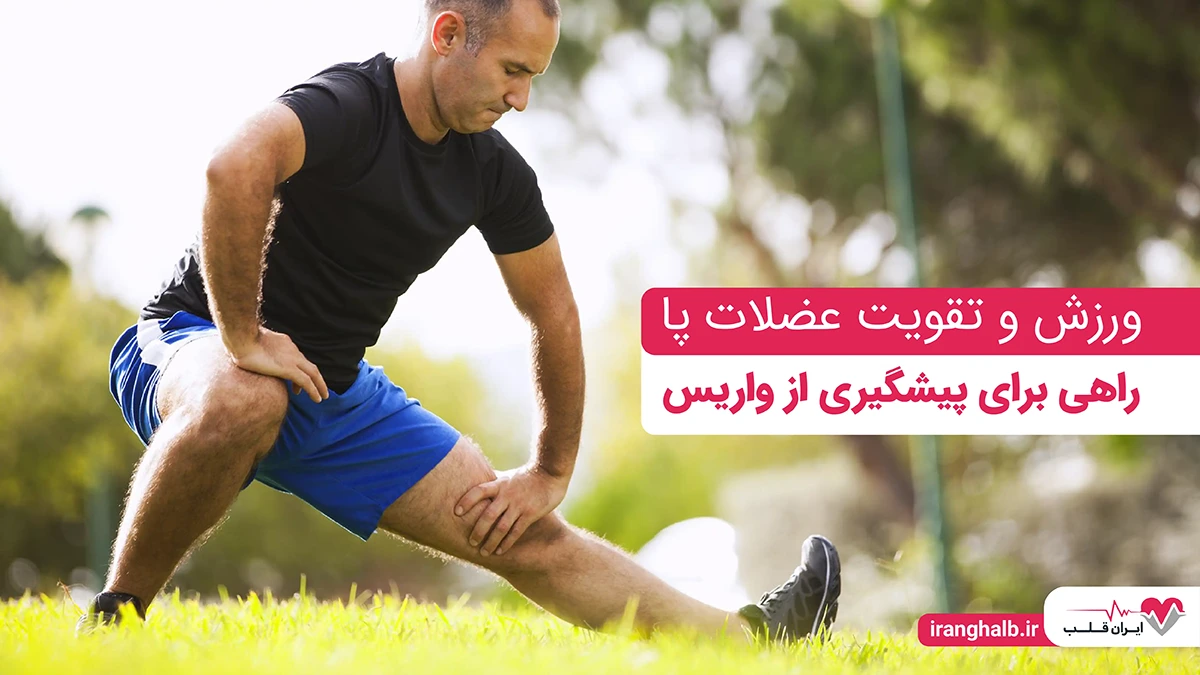 ورزش و تقویت عضلات پا راهی برای پیشگیری از واریس ورزش و تقویت عضلات پا راهی برای پیشگیری از واریس