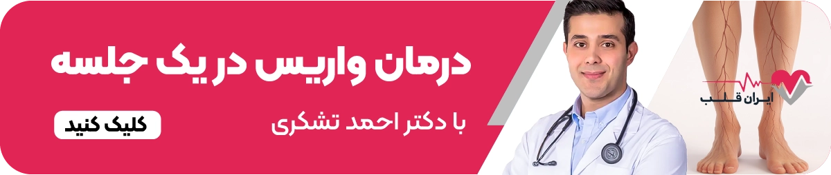 درمان واریس