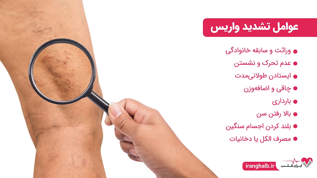 عوامل تشدید واریس عوامل تشدید واریس