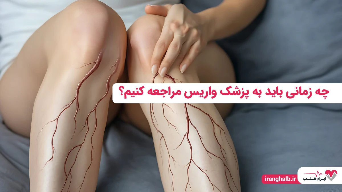 چه زمانی باید به پزشک واریس مراجعه کنیم؟ چه زمانی باید به پزشک واریس مراجعه کنیم؟