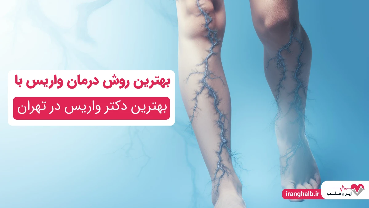 بهترین روش درمان واریس با بهترین دکتر واریس در تهران بهترین روش درمان واریس با بهترین دکتر واریس در تهران
