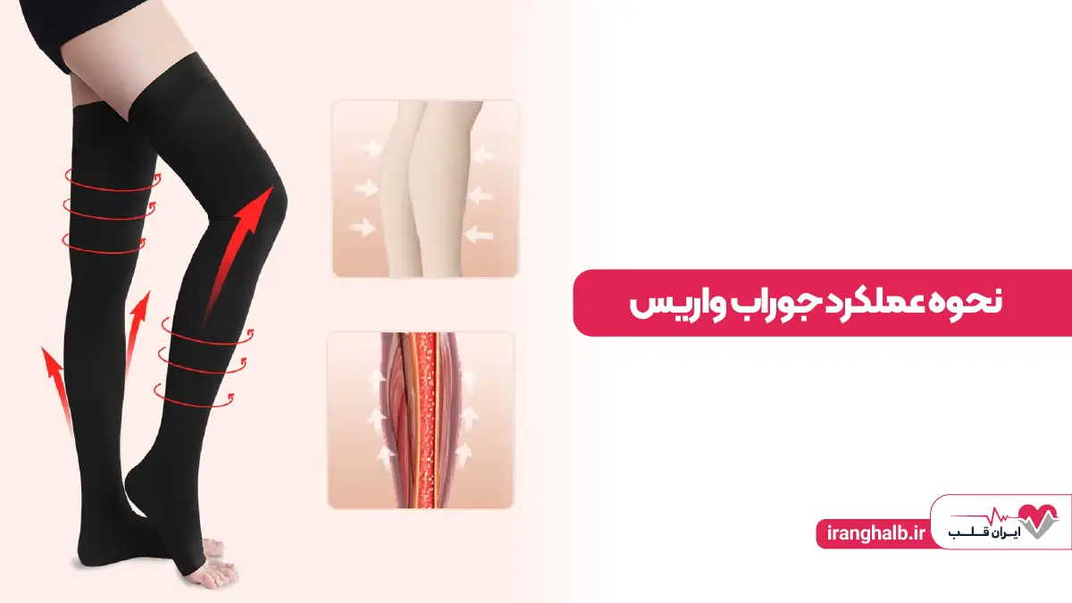 نحوه عملکرد جوراب واریس چگونه است ؟ نحوه عملکرد جوراب واریس چگونه است ؟