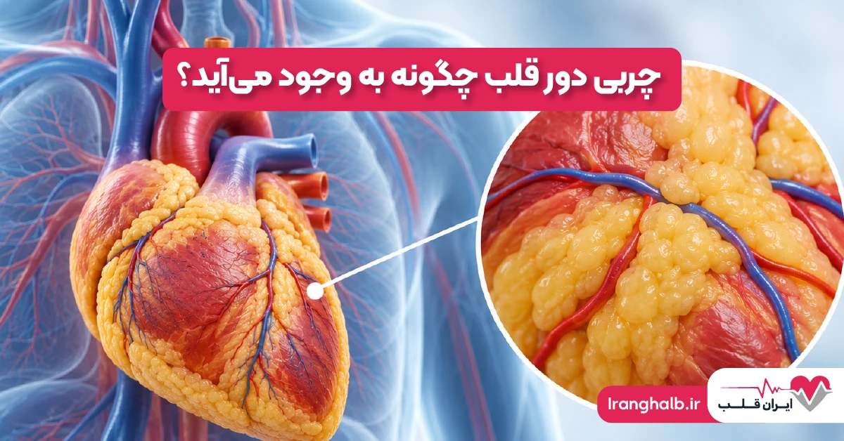 چربی دور قلب چگونه به وجود می آید؟ چربی دور قلب چگونه به وجود می آید؟
